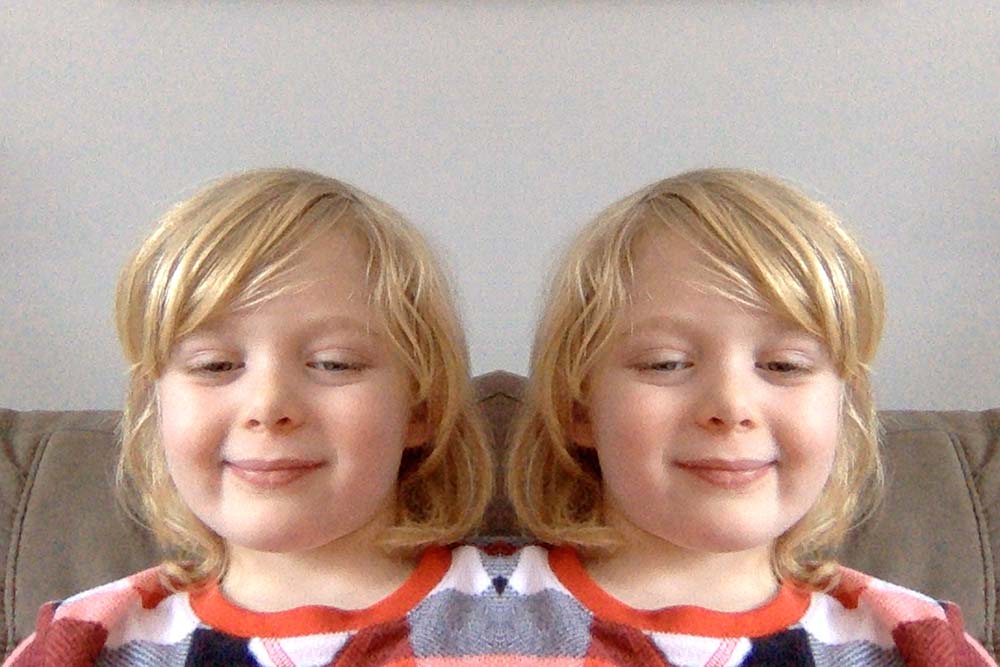 A photo of a two-headed girl smiling.